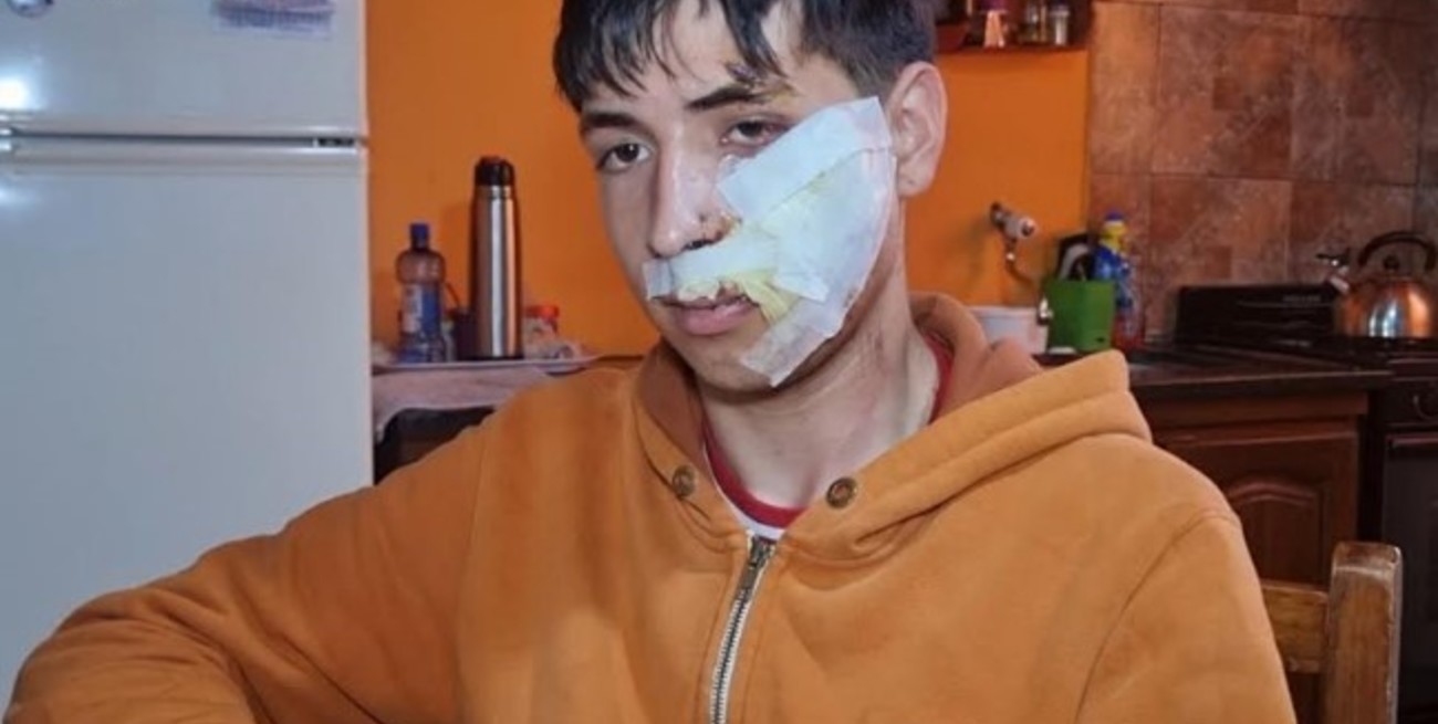 Feroz golpiza a un joven en Casilda: "Vamos a hacer lo que sea para esclarecer todo esto"