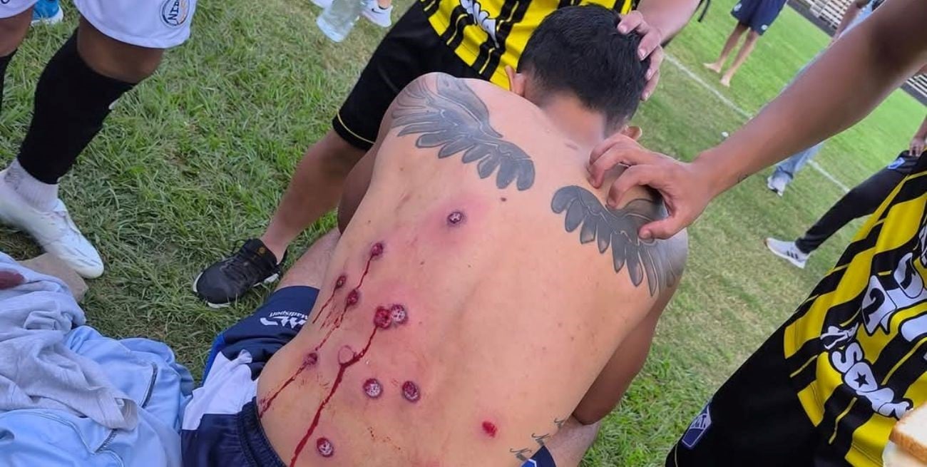 Video: otro domingo manchado por la violencia en el Regional Federal Amateur