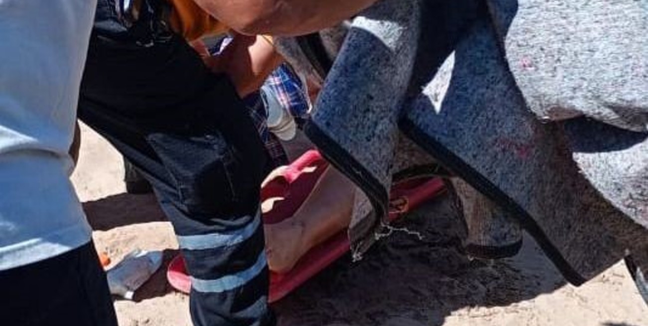 Una motociclista chocó y terminó con el "apoyapié" clavado en la pantorrilla