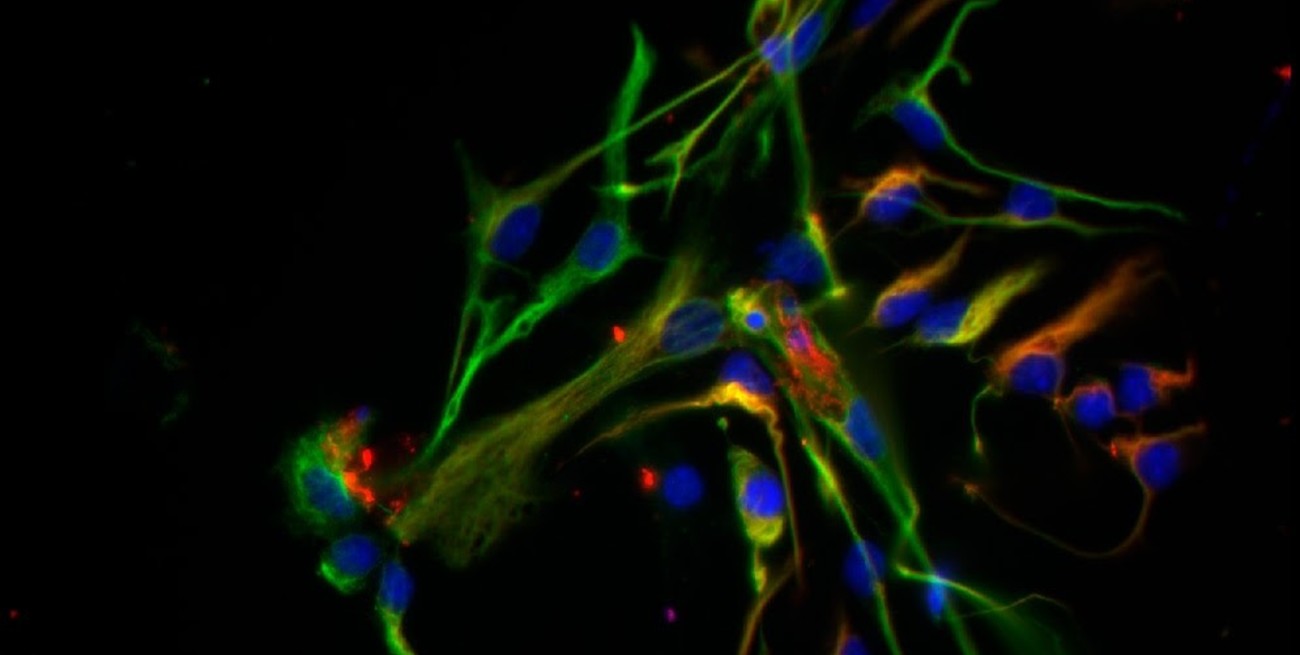 Hacia una terapia de origen biológico contra el Parkinson