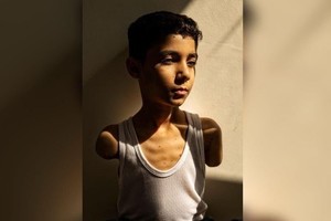 En Gaza: "Mahmoud Ajjour, de nueve años", foto ganadora del World Press Photo 2025. 