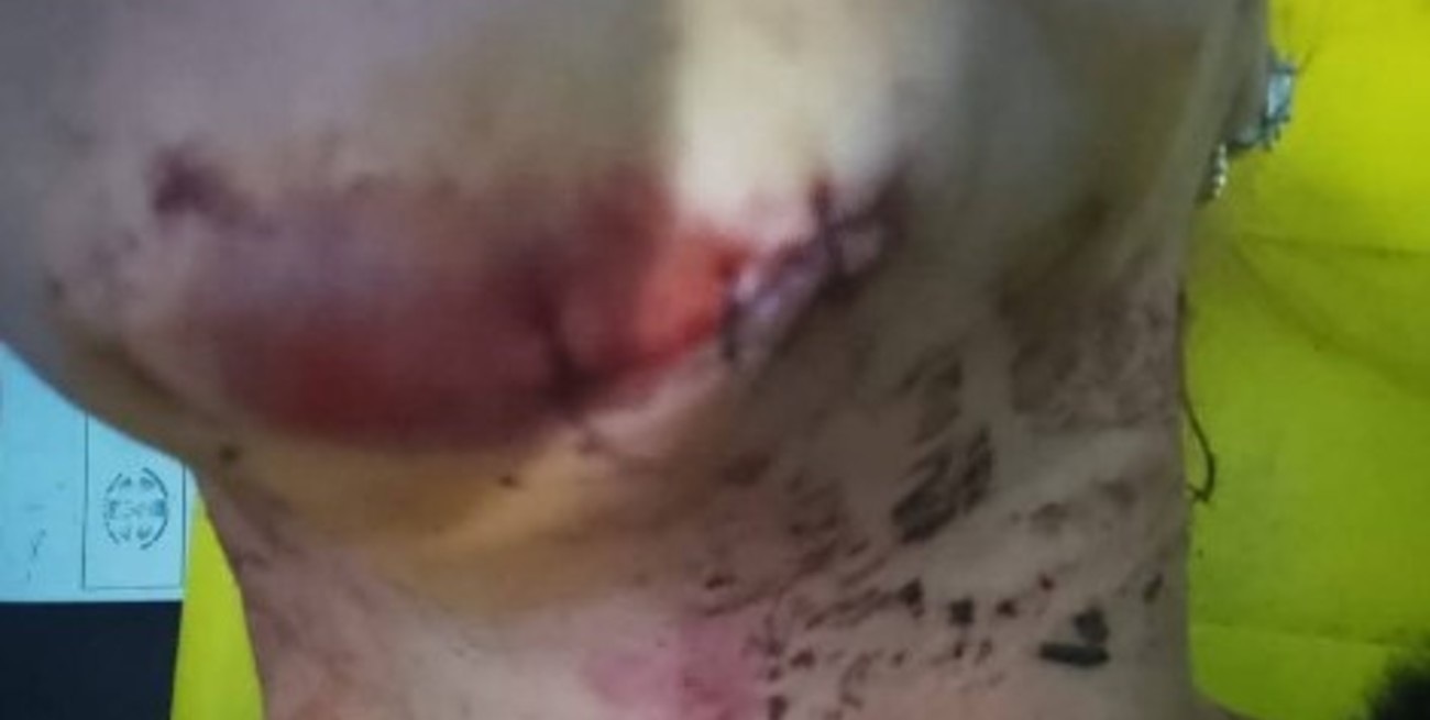 Piden testigos de un brutal choque en Alto Verde ; un automovilista la atropelló y se dio a la fuga