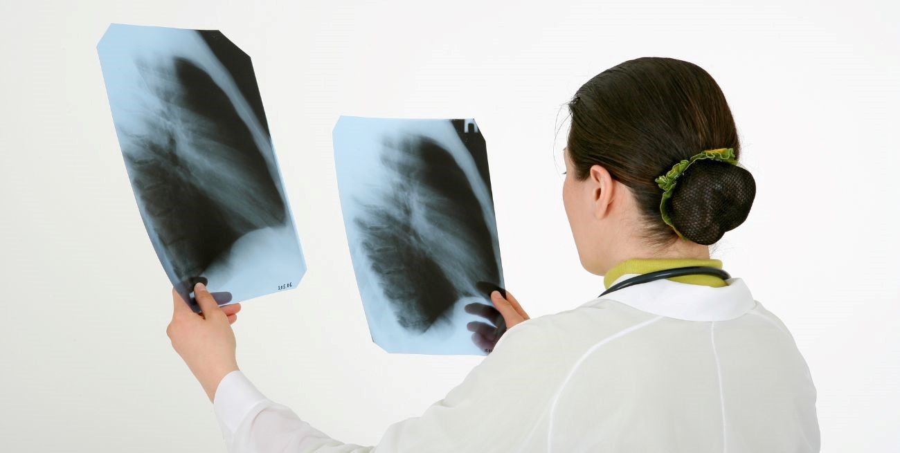 Neumonía: bajo índice de vacunación en adultos
