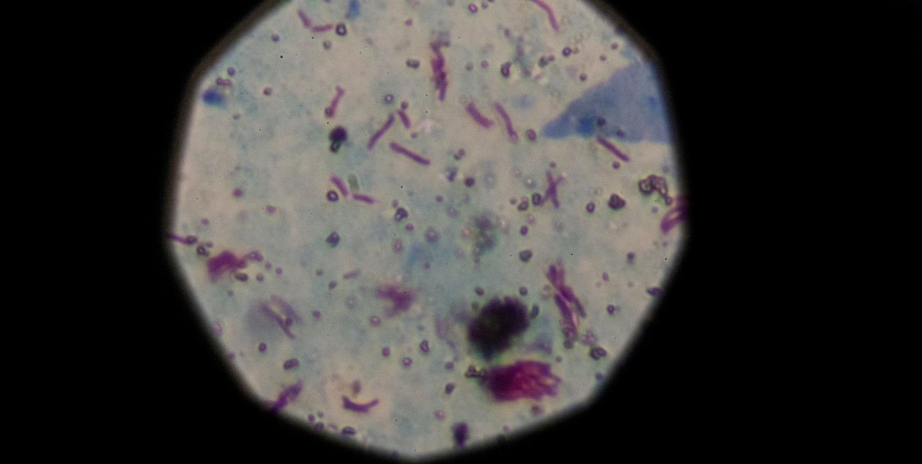 La tuberculosis creció casi un 40% en Argentina debido a la baja inmunización
