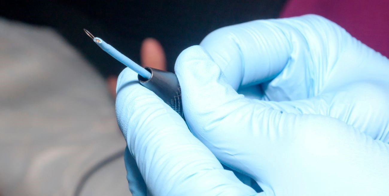 Se prohibió el uso de un electrodo médico por una serie de irregularidades