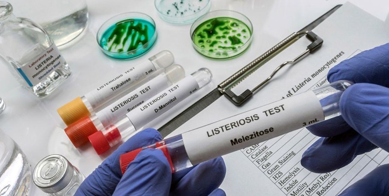 Brote de listeriosis: de qué se trata la enfermedad detectada en un queso que puede ser mortal