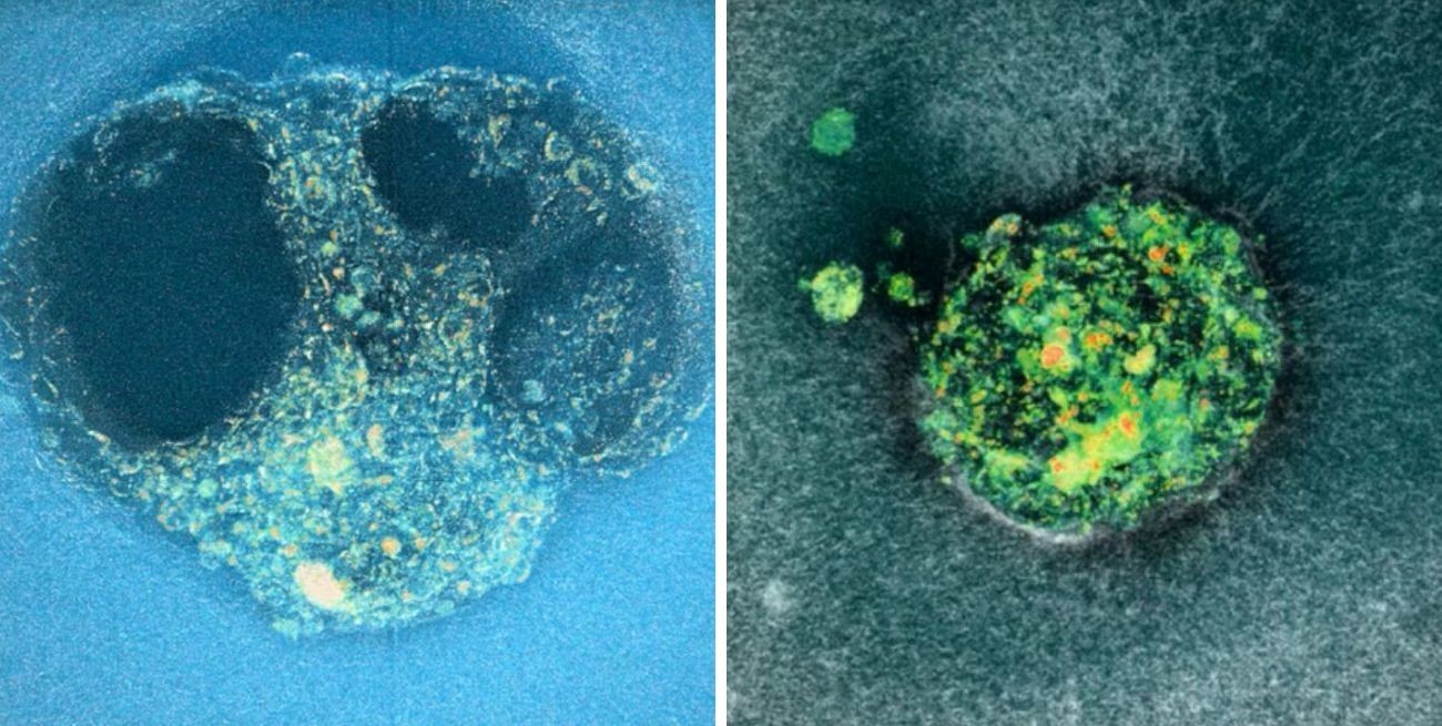 Video: registran por primera vez la implantación de un embrión humano