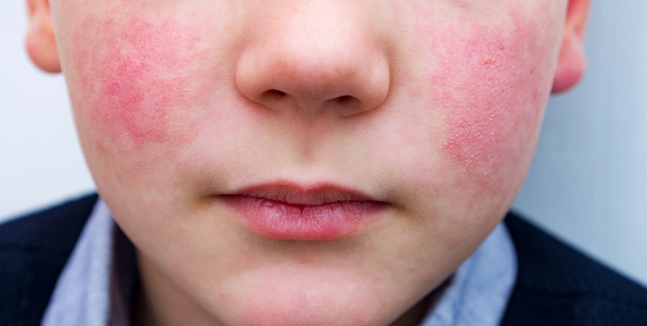 La quinta en primavera