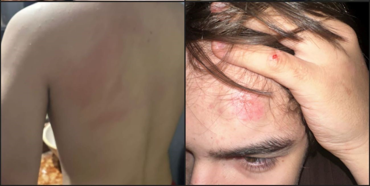 Por una pelea de perros: lastimó a un menor, amenazó a su padre y terminó en la comisaría