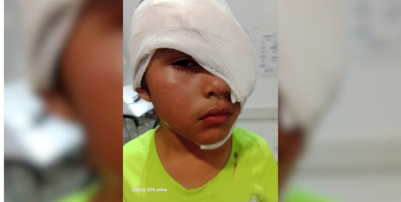 Una niña resultó con graves heridas en el rostro tras ser atacada por un pitbull