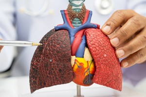 Cada año, más de 10.600 personas mueren por cáncer de pulmón en la Argentina.