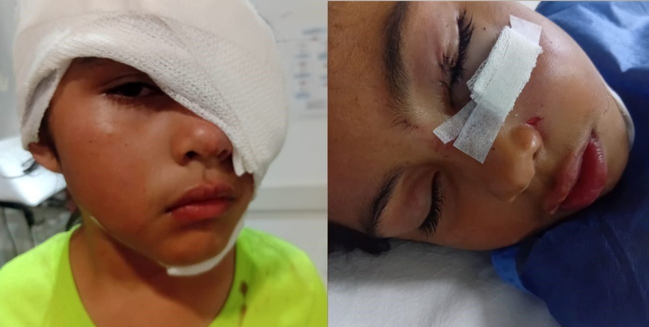 La nena mordida por un pitbull permanece internada pero con evolución favorable