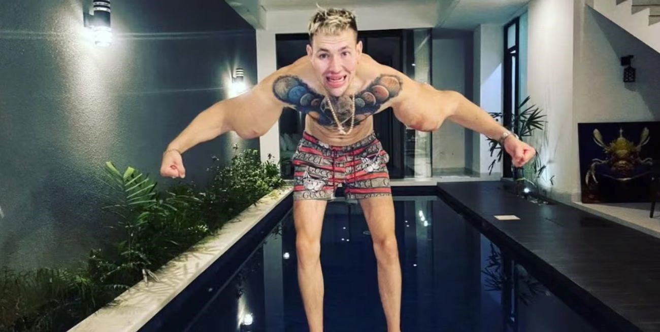 Obsesión por los bíceps: se inyectó vaselina y una infección podría costarle ambos brazos