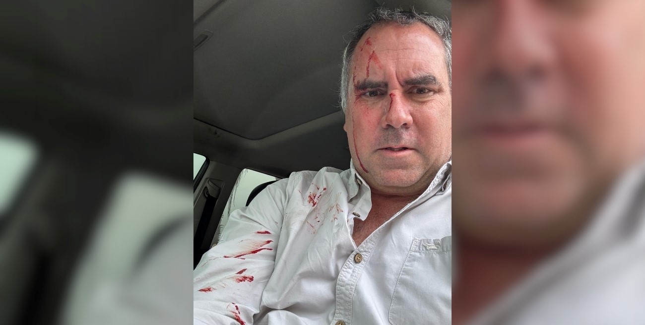 Atacaron a balazos a Rafael Belaúnde, candidato a presidente de Perú