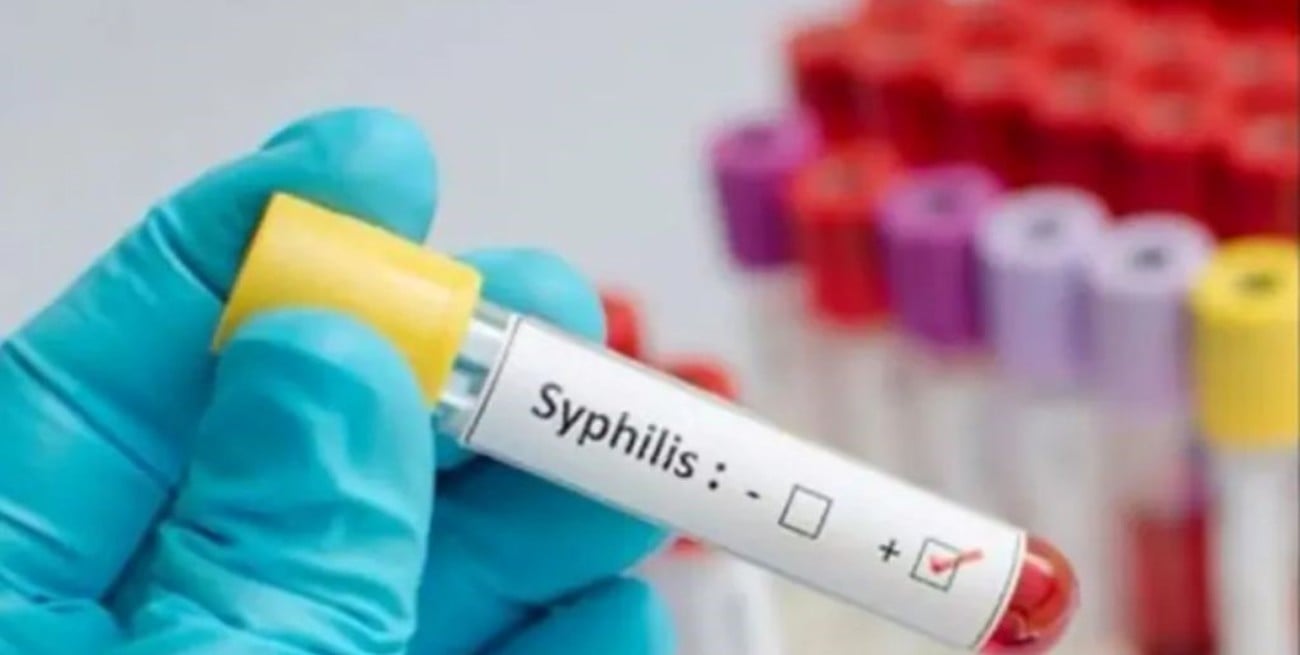 Sífilis en Rosario: aumento progresivo de casos y advertencia por reinfecciones frecuentes