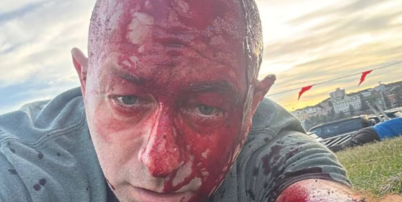 Sobrevivió al ataque de Hamás del 7 de octubre y volvió a ser herido en un atentado terrorista en Australia