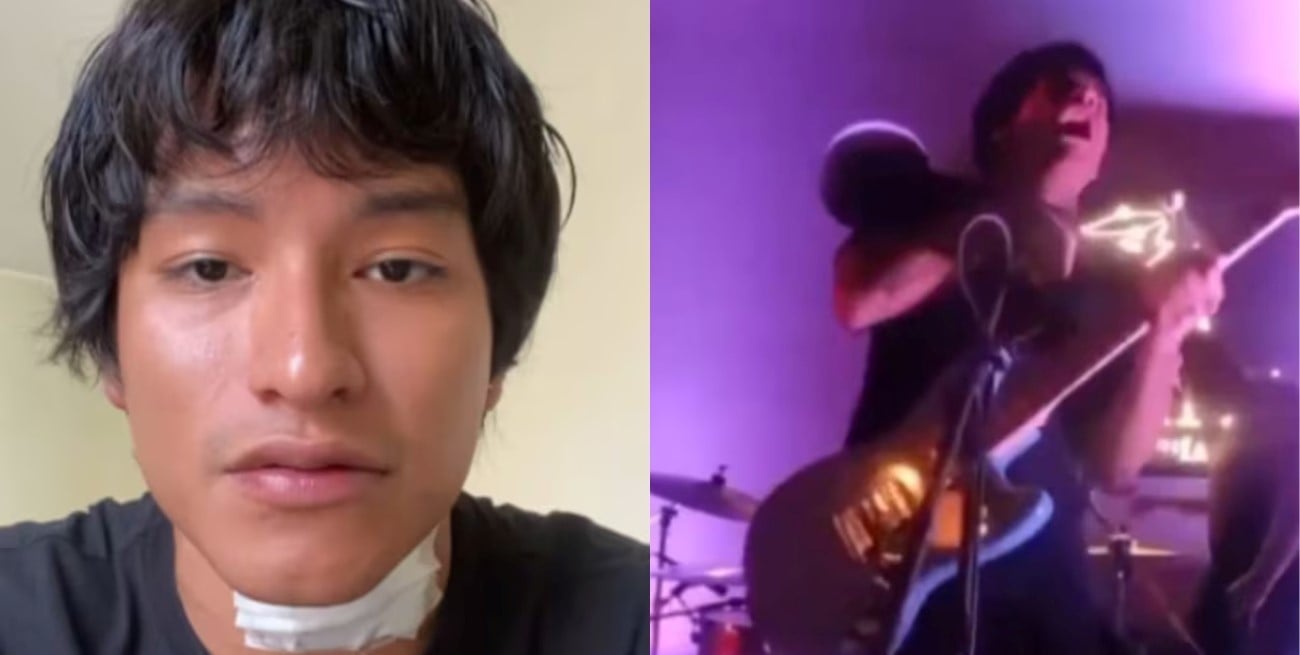 Se electrocutó en pleno show y sobrevivió: “No terminó en tragedia por suerte”