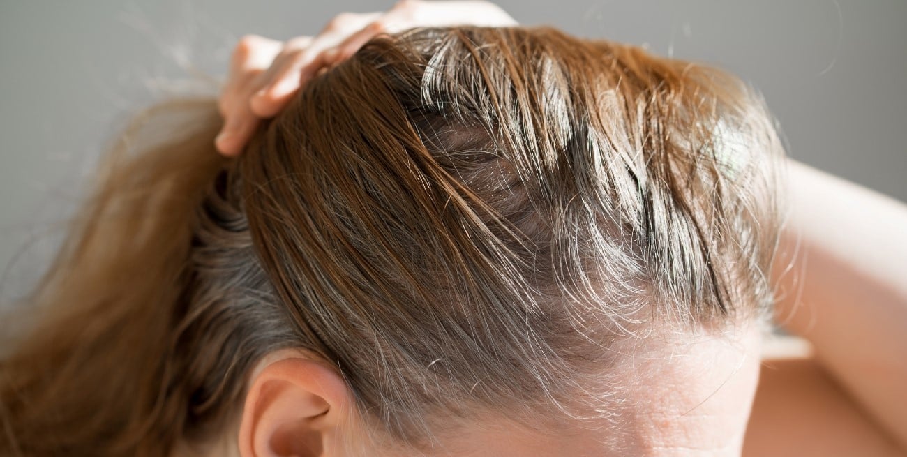 Qué vitaminas ayudan a prevenir la aparición de canas en el cabello