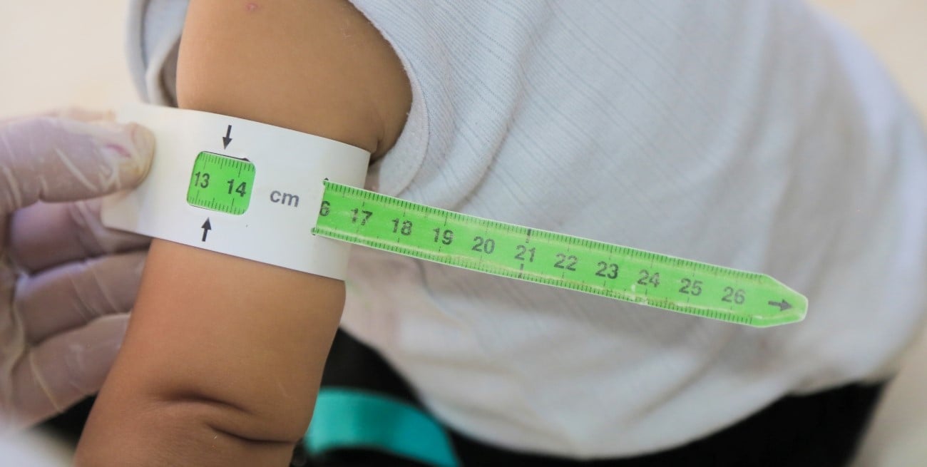 Desnutrición infantil en Santa Fe: aumentan las consultas en el sistema público y crecen los casos severos