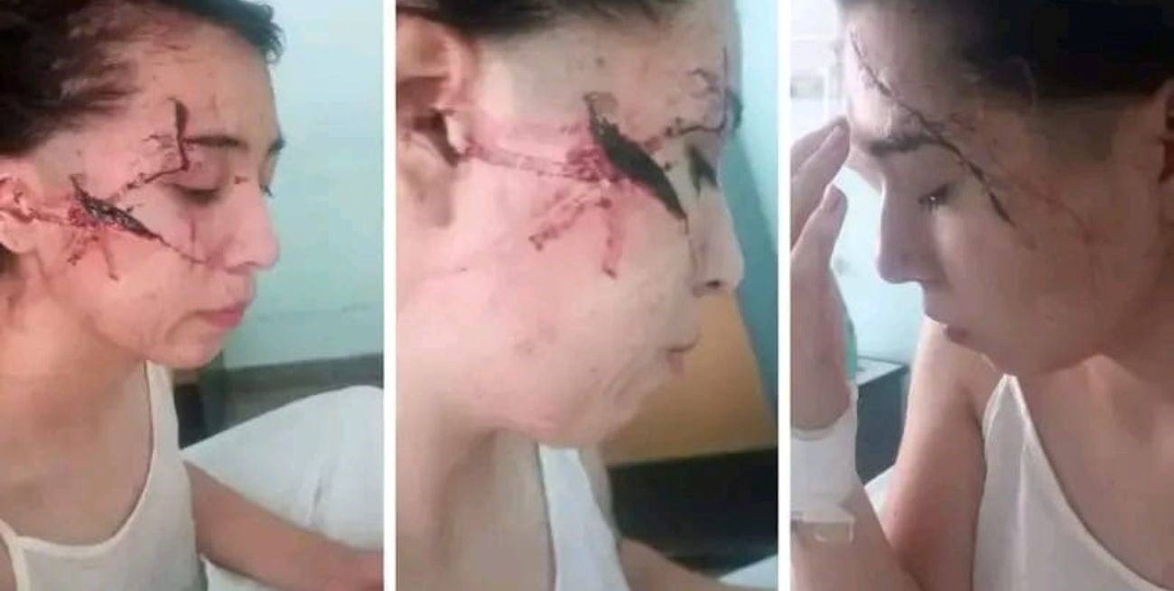 Delfina sobrevivió, pero el miedo sigue: la familia duda en regresar a San Cristóbal