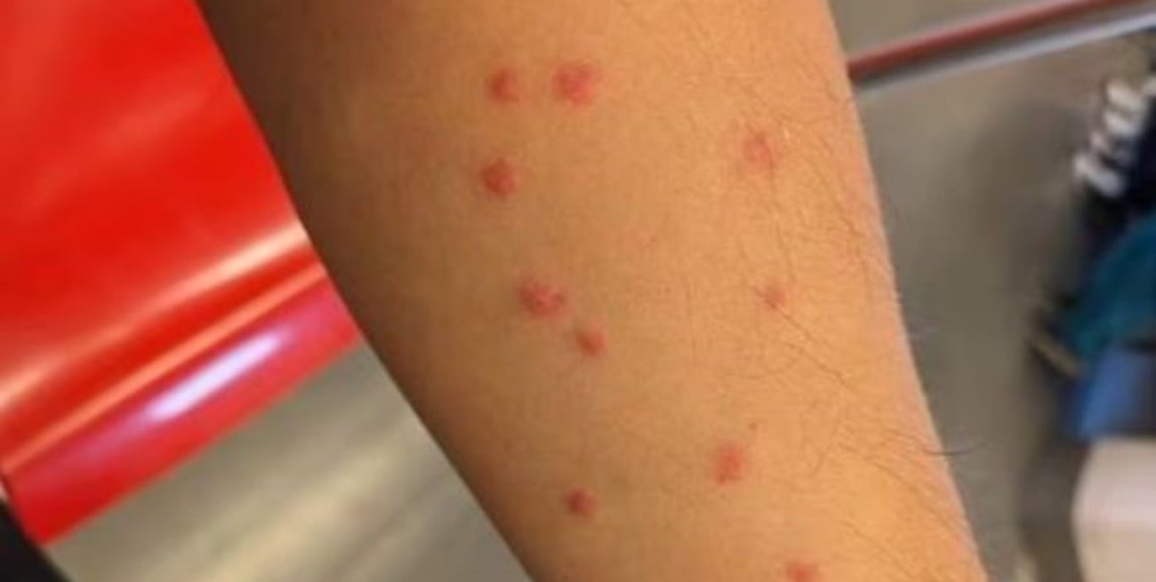 El alerta por la presencia de la "mosca que muerde" se extiende en la zona del Río de la Plata