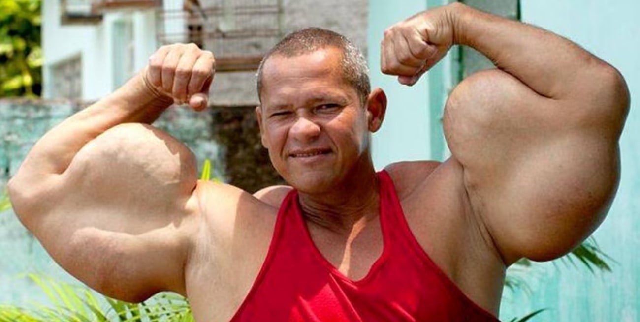 Murió “Popeye brasileño”: el fisicoculturista que se inyectaba aceite para aumentar sus bíceps