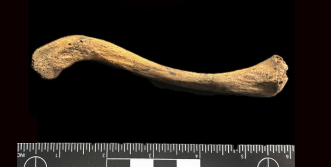 Hallan la prueba más antigua de una bacteria causante de sífilis y múltiples enfermedades