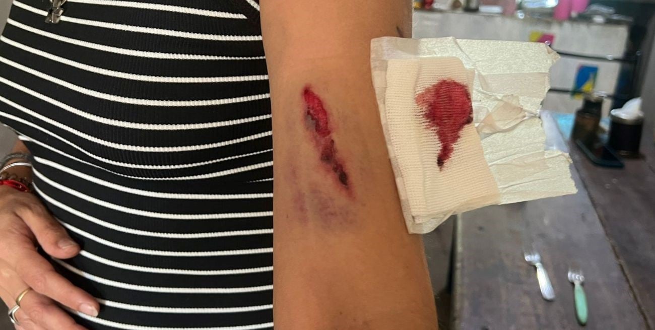 “Pensé que me venían a matar”: el relato de la hermana del intendente tras el ataque a tiros en Rincón