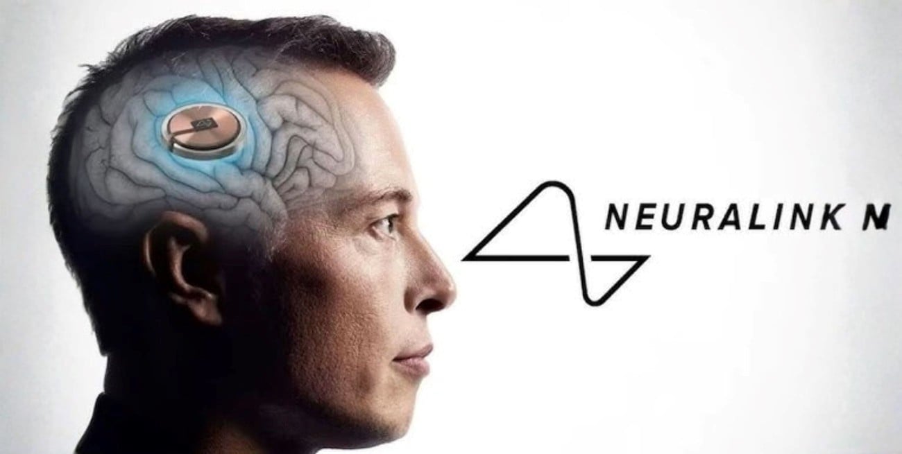 Cómo funciona el implante humano para curar la ceguera que quiere crear Elon Musk