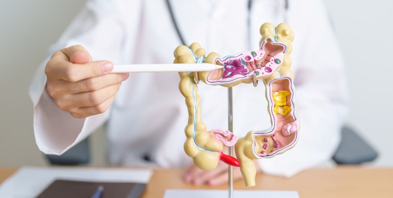 Cáncer de colon: el riesgo se duplica ante antecedentes familiares o mutaciones genéticas