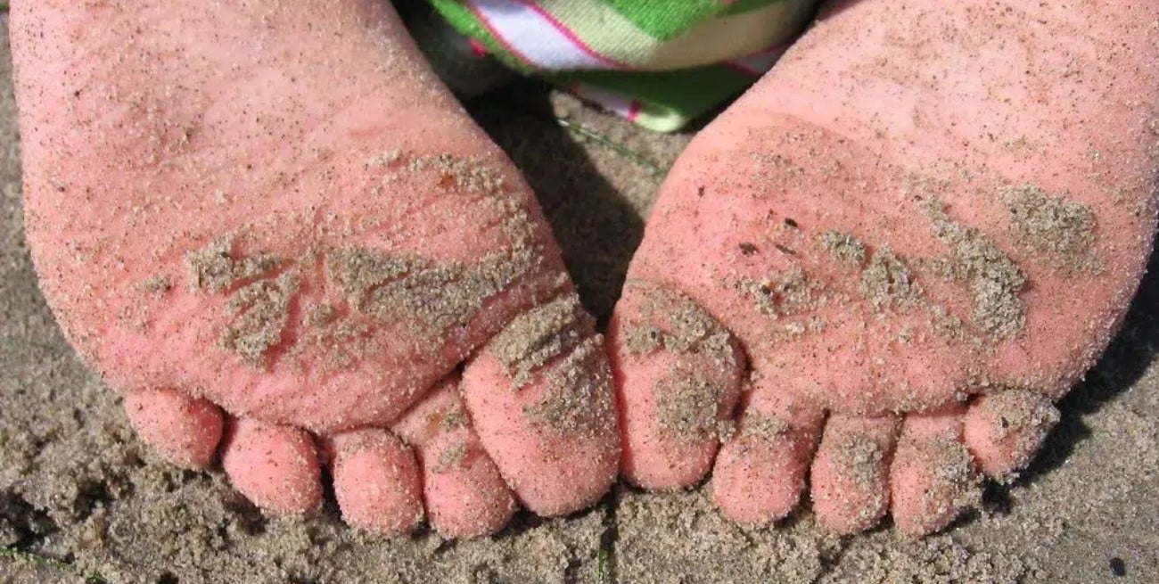 Bicho de pé en Brasil: qué es, riesgos y cómo prevenir picaduras