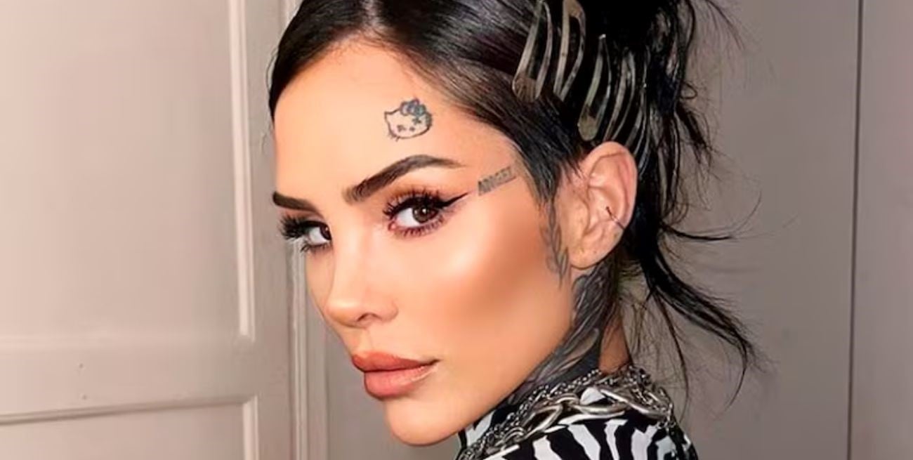 Cande Tinelli comenzó a borrar el tatuaje de Hello Kitty que tiene en su cara: así es el tratamiento