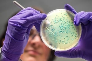 El hallazgo en el permafrost refuerza la preocupación por el impacto del deshielo.