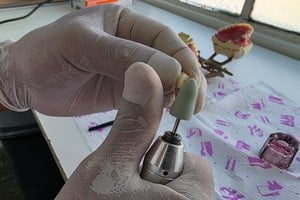 La iniciativa se inscribe en una política integral de salud bucal, con eje en la atención preventiva, el trabajo en red y la priorización de pacientes en situación de mayor vulnerabilidad.