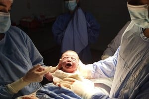 La reunión tuvo como eje central la implementación de los lineamientos CONE (Cuidados Obstétricos y Neonatales Esenciales), tanto en el primer nivel de atención como en el ámbito hospitalario.