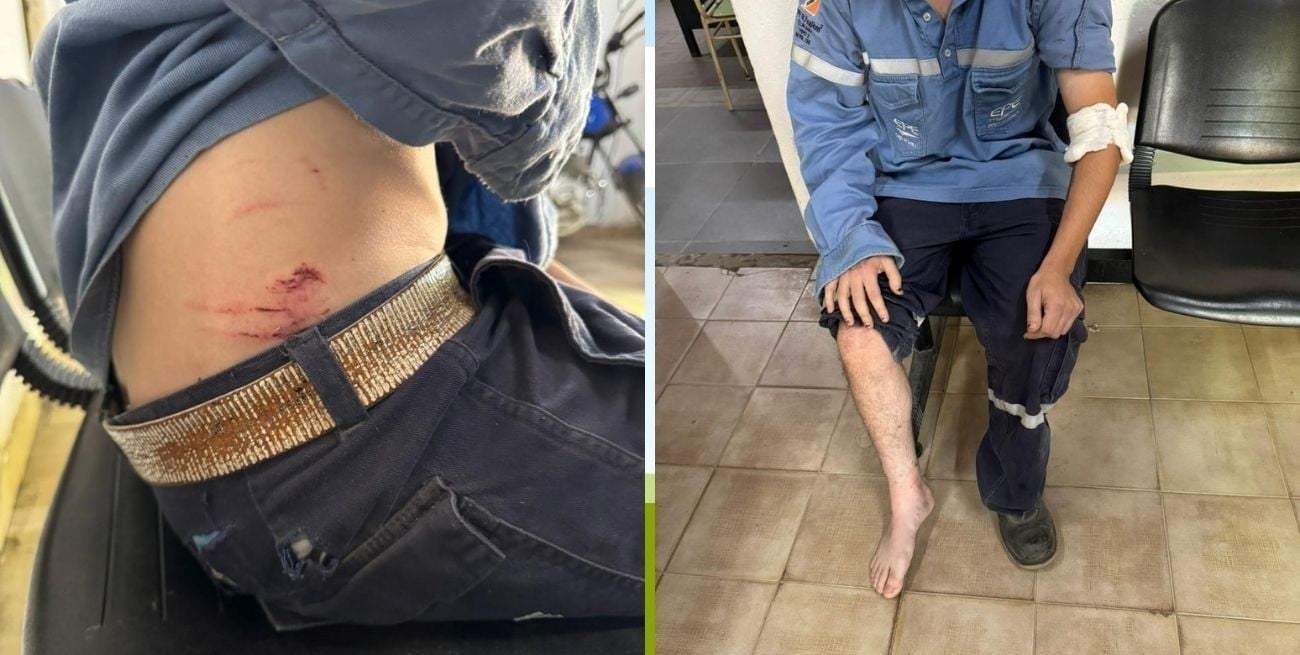 Jauría de perros atacó y casi mata
a un operario de la EPE en Santa Fe