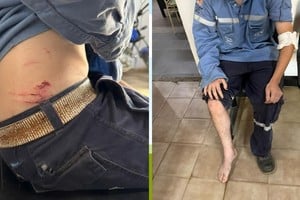 El trabajador recibió asistencia médica y se encuentra en buen estado. Foto: Gentileza