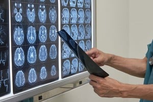En el mundo la neurocirugía representa el máximo escalafón de la complejidad médica. 