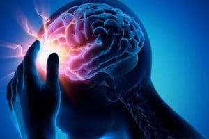 La encefalitis por flavivirus es una inflamación del cerebro provocada por virus