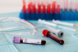 Fenómenos poco frecuente obligan a extremar cuidados médicos y fortalecer redes de donación específicas