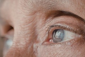 La suplementación puede ayudar a proteger la retina frente al estrés oxidativo.