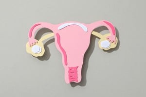 El cáncer de ovario puede afectar a mujeres de distintas edades