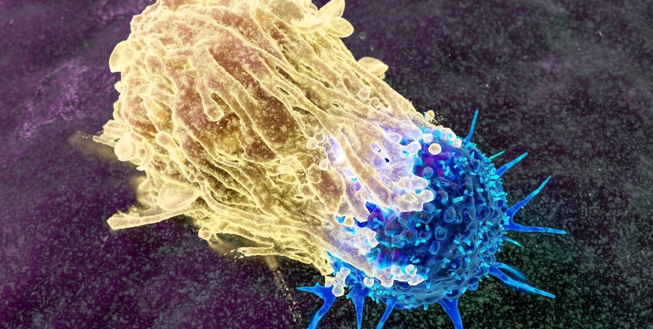 Cáncer de páncreas: el avance científico que podría cambiar el tratamiento de la enfermedad