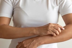 La piel no necesariamente presenta lesiones visibles, pero sí una alteración de su barrera protectora.
