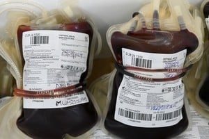 Colectas públicas organizadas por el Centro Único de Donación, Ablación e Implante de Órganos