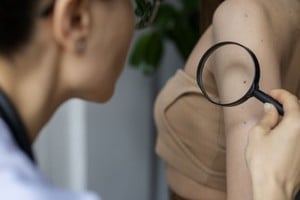 Prevención Salud promueve hábitos de cuidado para reducir los riesgos asociados a la radiación ultravioleta.