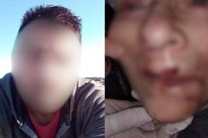 El trabajador le habría propinado un golpe con una cuchara a una de las residentes.