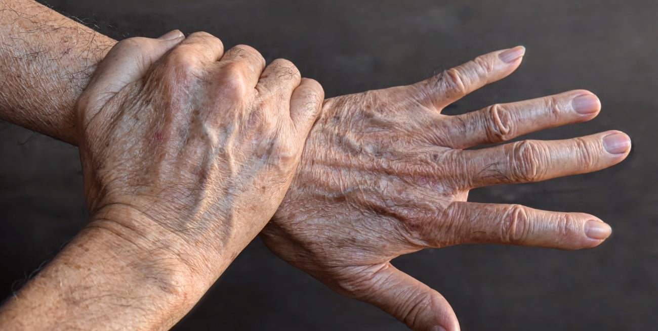 ¿Te salen manchas en las manos? Las causas más comunes y cuándo consultar al médico
