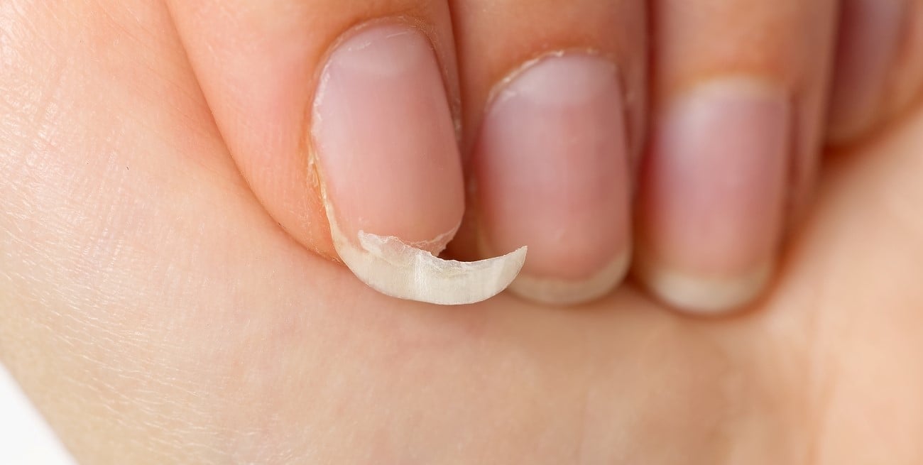 ¿Por qué tenés las uñas frágiles? Las causas más comunes y qué podés hacer para fortalecerlas
