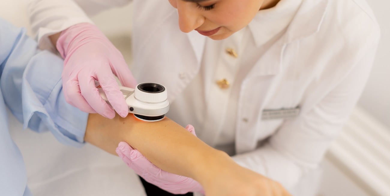 La ANMAT prohibió un dermatoscopio utilizado en dermatología: cuál es el equipo